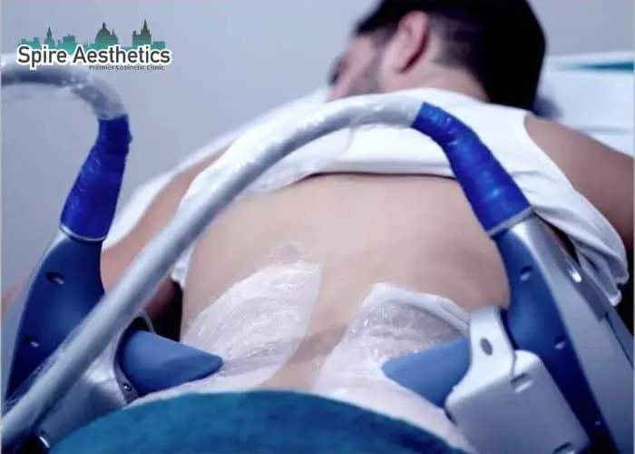 Man having fat freezing treatment done on love handles before a competitions Drumbrae to create a sculpted look.